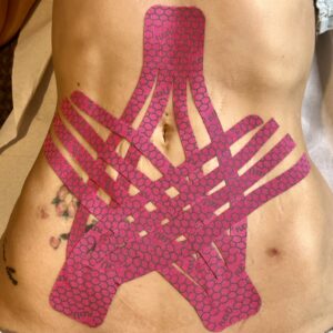 Post Operative Care - Advanced Lymphatic drainage