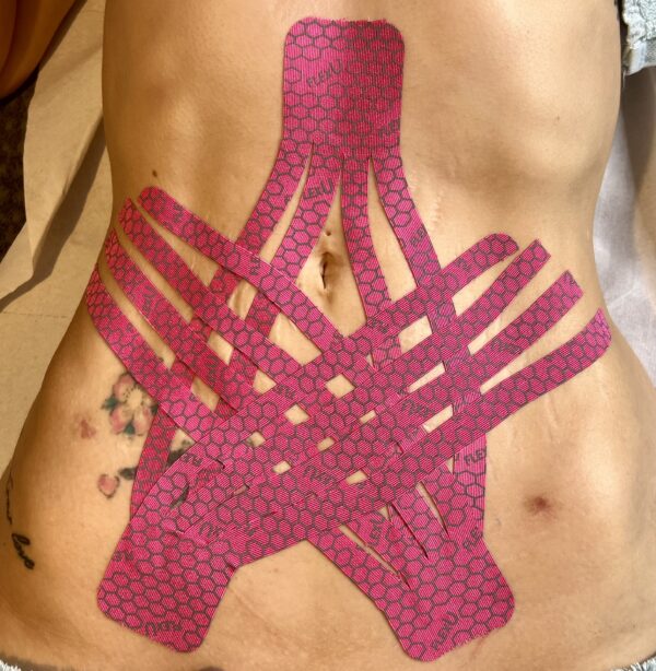 Post Operative Care - Advanced Lymphatic drainage
